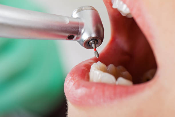 Best Walk-In Emergency Dentist in Castle Rock, WA